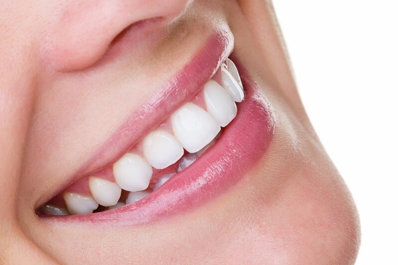 idealne zęby