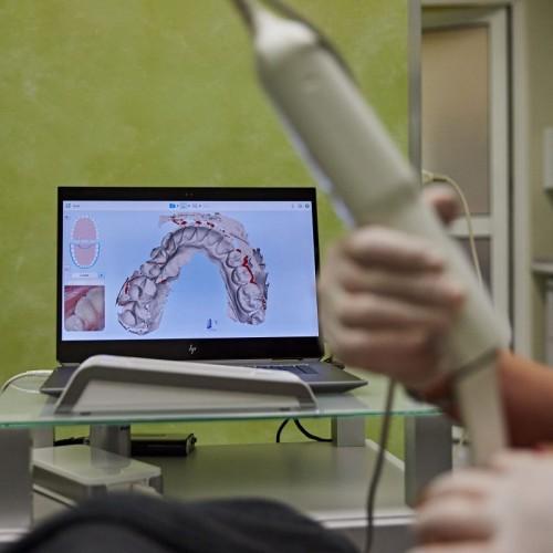 urządzenie prześwietlające uzębienie