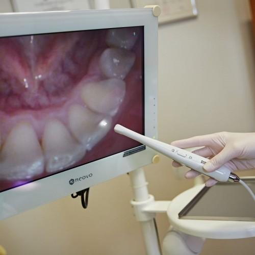 zdjęcie uzębienia na monitorze